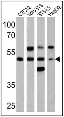 Western Blot: PPAR alpha/NR1C1 [p Ser12] Antibody [NB120-3484]